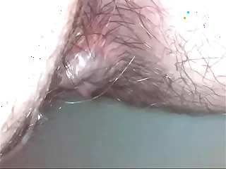 asshole